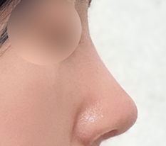 얼굴에 입체감 생겼으용