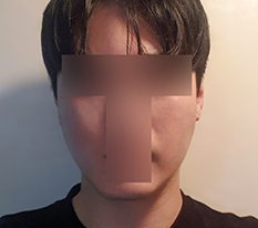 효과 좋았습니다