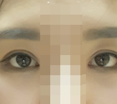몰라보게 달라진 눈