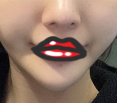 밀착실리프팅 효과 대박 터졌어요!