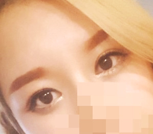 눈성형 강추에요!!!!