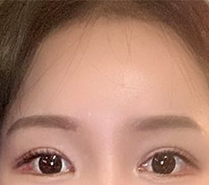3달된 이마거상이에요