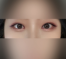 라인 원래 엄청 과했는데 ㅠ