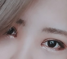 눈성형 최고에욤!
