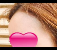 볼록볼록해졌어용