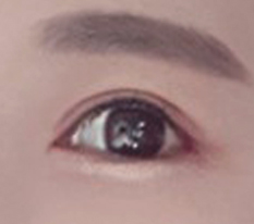 만족만족 눈성형ㅁ