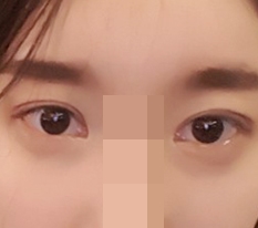 원장님 감사해엽