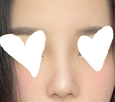 복코교정 완전 잘 됐어요^,^