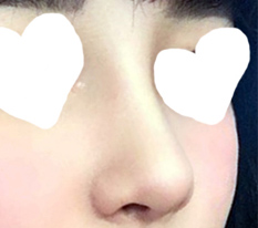 다들 코보고 놀랬어요 ;;;;