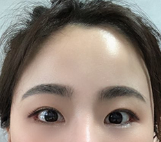 이마거상 3개월차에용