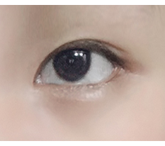 꼬막눈 탈출
