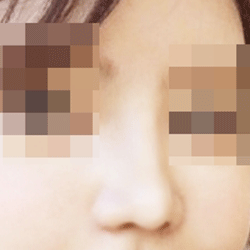이성표원장님 감사합니다