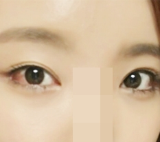 퍼펙트빅아이+듀얼트임 받았어요
