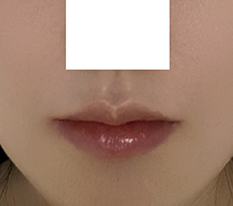 입술 말끔~