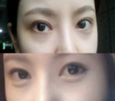 이젠나도 또렷한 눈매로 살아가고있지욧 꺄
