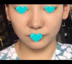코가 예뻐져서 좋아요!