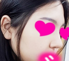 호박같은 코 에서 오이같은 코 로 ㅋㅋ