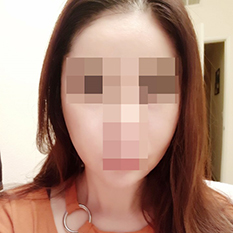 광대축소 대박ㅎㅎ