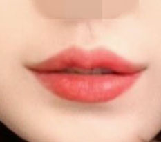 울상에서 웃상된 후기