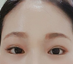 이마거상으로 또렷해져서 좋아요^^