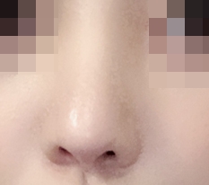 뾰족했던 코 끝이 부드럽게!