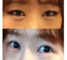 절개만 했는데 부드러운 이미지로 바꼈어요^^