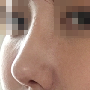 라인 잘 잡아 주셨어요 ㅎ