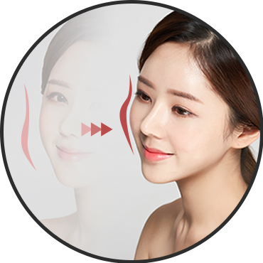 라인 — 45도 측면 광대라인(오지커브)
