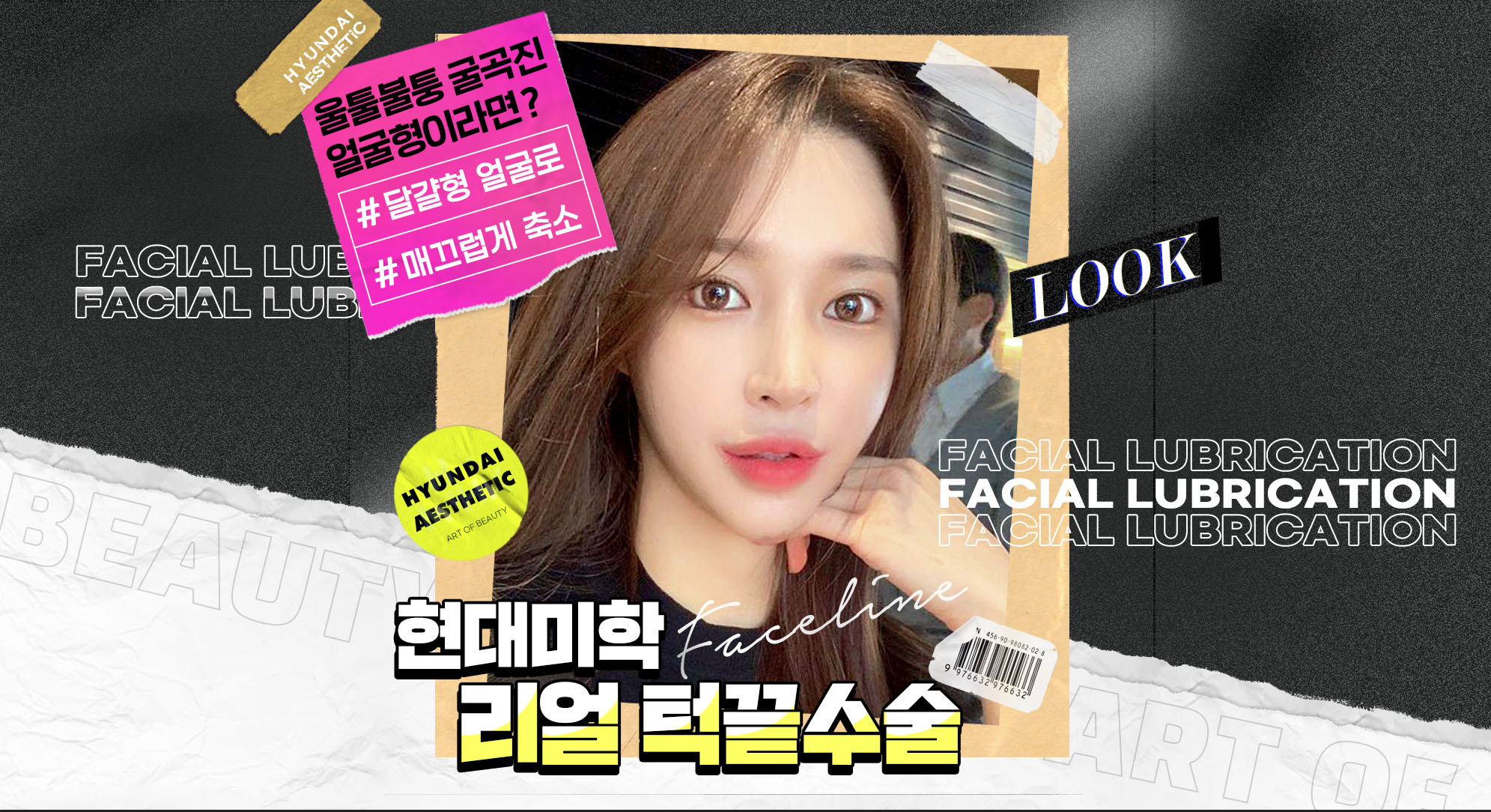 현대미학 리얼 턱끝수술 — 굴곡진 울퉁불퉁 얼굴형을 #달걀형 얼굴로 축소
