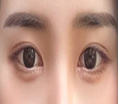 현대미학베스트셀피