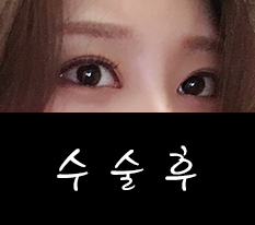 현대미학베스트셀피