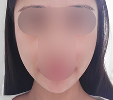 현대미학베스트셀피