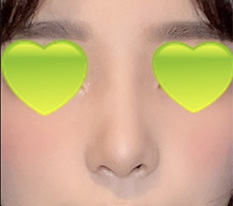 현대미학베스트셀피
