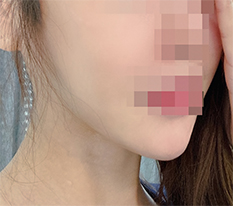 현대미학베스트셀피