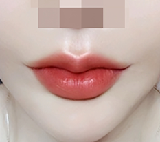 현대미학베스트셀피
