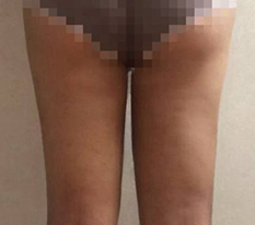 현대미학베스트셀피