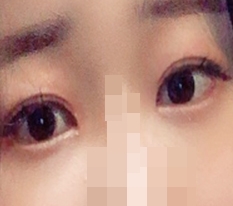 현대미학베스트셀피