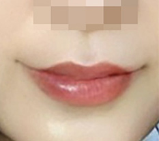 현대미학베스트셀피