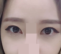 현대미학베스트셀피