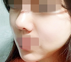 현대미학베스트셀피