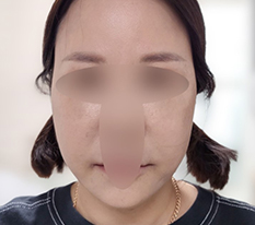 현대미학베스트셀피