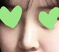 현대미학베스트셀피