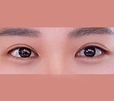 현대미학베스트셀피