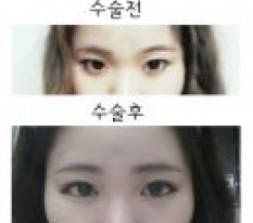 현대미학베스트셀피
