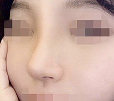 현대미학베스트셀피