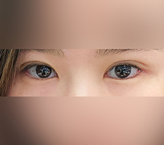 현대미학베스트셀피