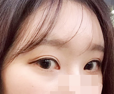 현대미학베스트셀피