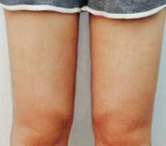 현대미학베스트셀피