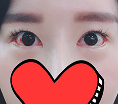 현대미학베스트셀피