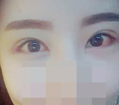 현대미학베스트셀피